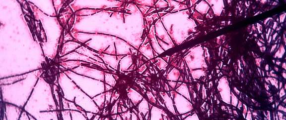 Bacillus subtillus, normal soil and human gut bacteria. Photo by Felix Tsao, www.felixtsao.com